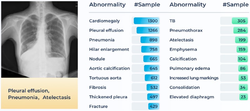 A chest X-ray image alongside potential diagnoses